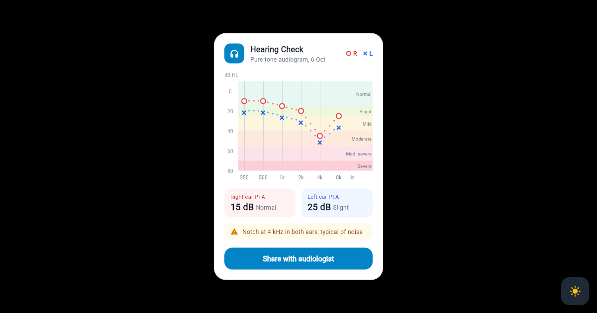 Flutter Hearing Test Card with Audiogram Ear Markers and Severity Bands preview